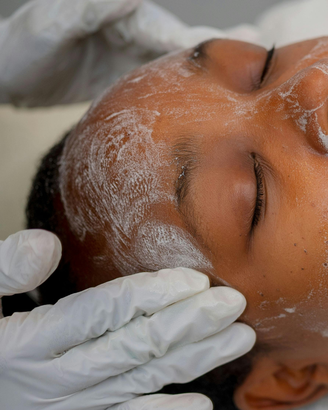 The Skin Centre Treatments